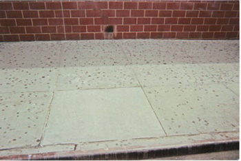 Gum Removal
